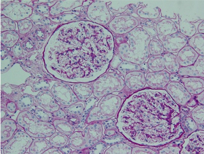 腎生検所見（PAS 染色，中拡大）
